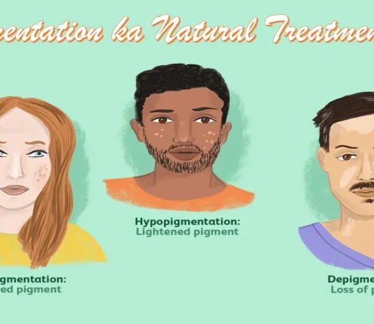Pigmentation ka Natural Treatment
